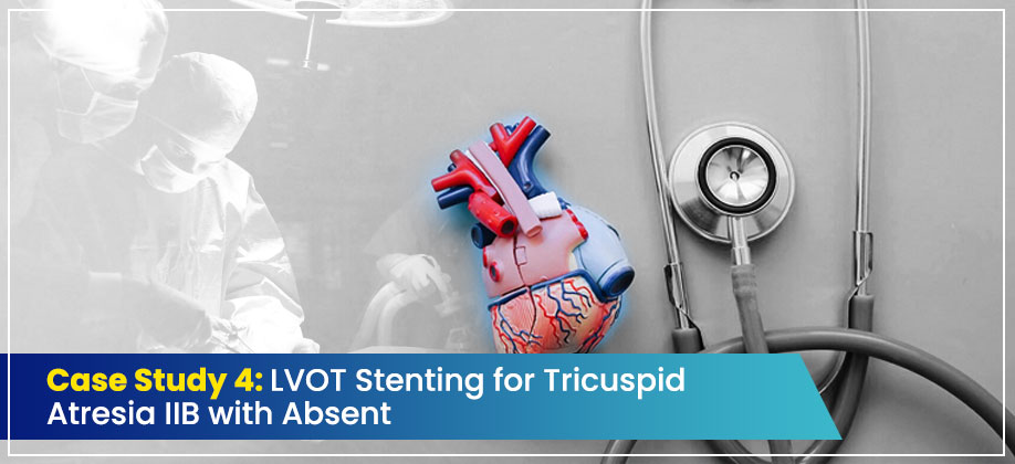 Case Study 4: LVOT Stenting for Tricuspid Atresia IIB with Absent PDA