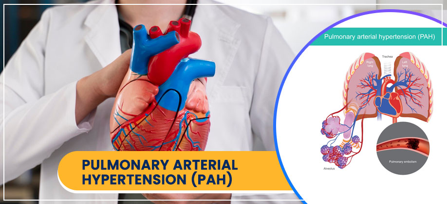 Pulmonary Arterial Hypertension (PAH)