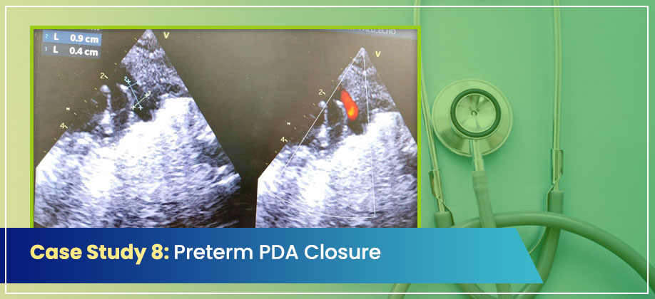 Case Study 8: Preterm PDA Closure